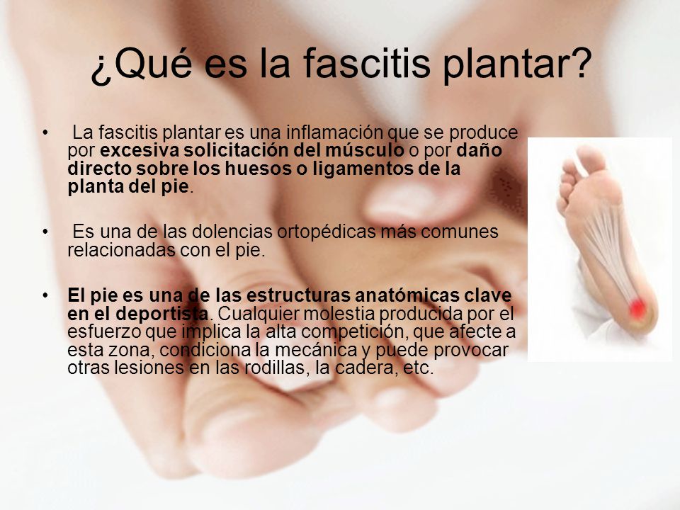 Inflamacion de los musculos de la planta del pie
